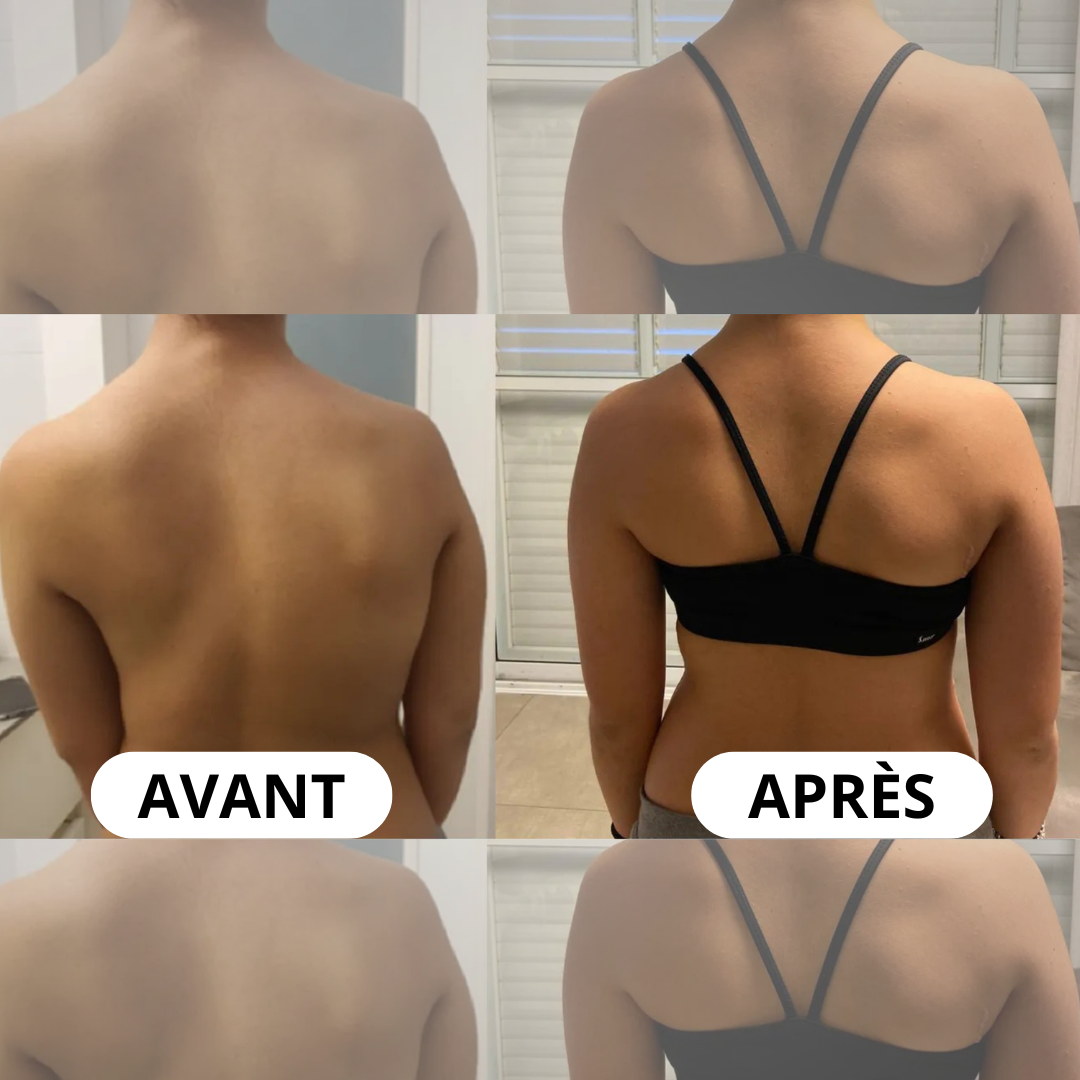 Correcteur de posture instantané