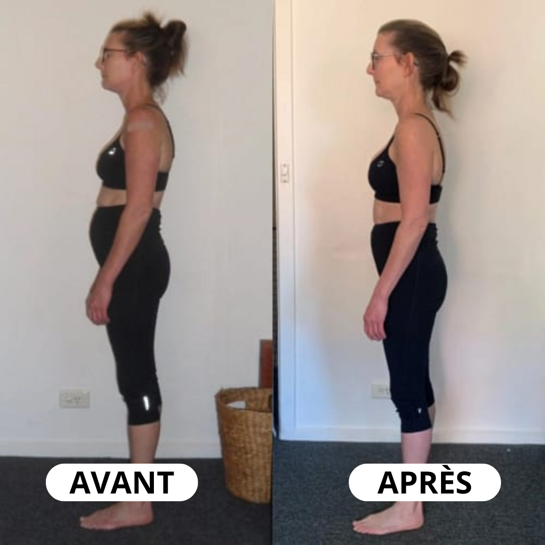 Correcteur de posture instantané