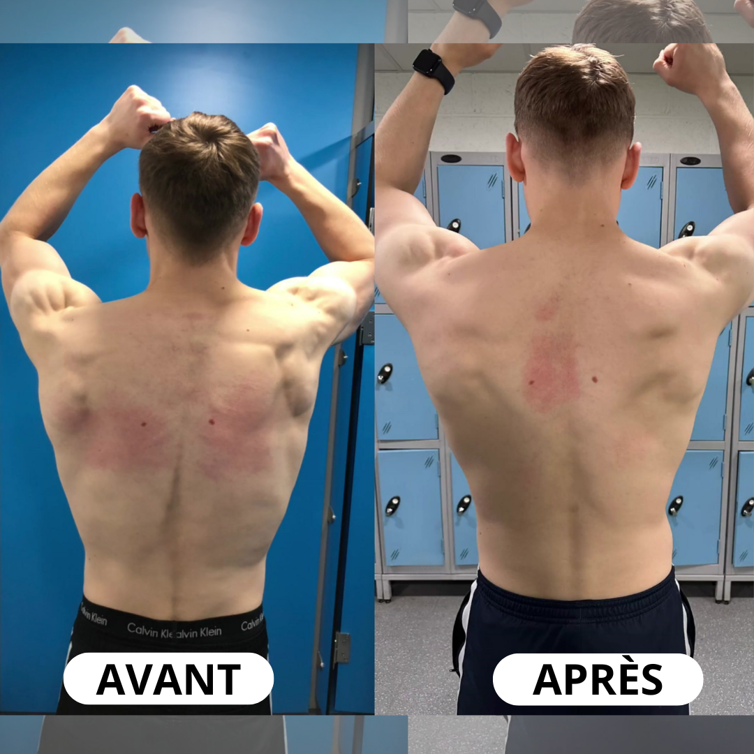 Correcteur de posture instantané